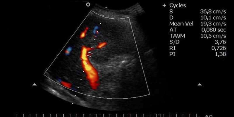 PLACENTAL FLOW